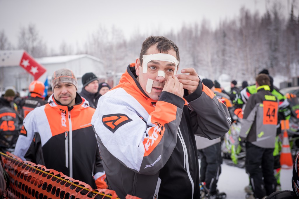 Riders put Duct tape or surgical tape on their face not protected by goggles or helmet to avoid frostbite | Roger Clifford, Official Iron Dog Photographer